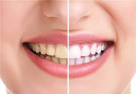 روش های ترمیمی و زیبایی دندان