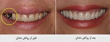 روش های ترمیمی و زیبایی دندان