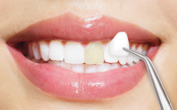 دندانپزشک-2