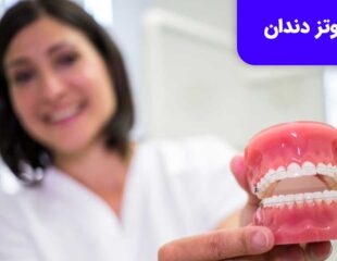 پروتز دندان برای کسانی مناسب است که به هر دلیلی دندان خود را از دست داده اند