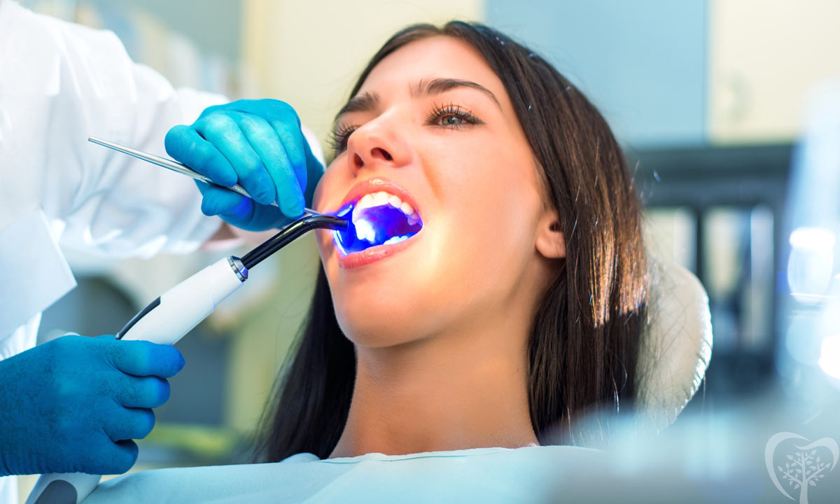 پر کردن دندان توسط دندان پزشک