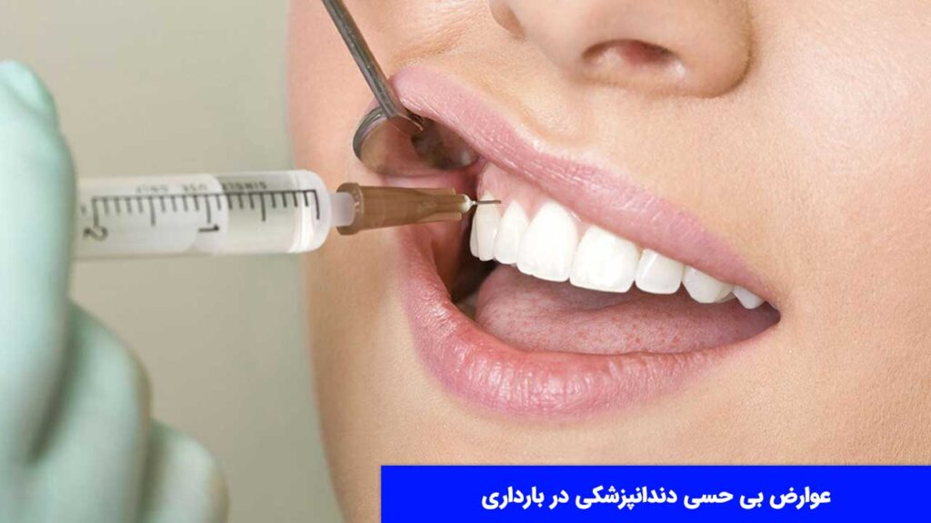 عوارض بی حسی دندانپزشکی در بارداری