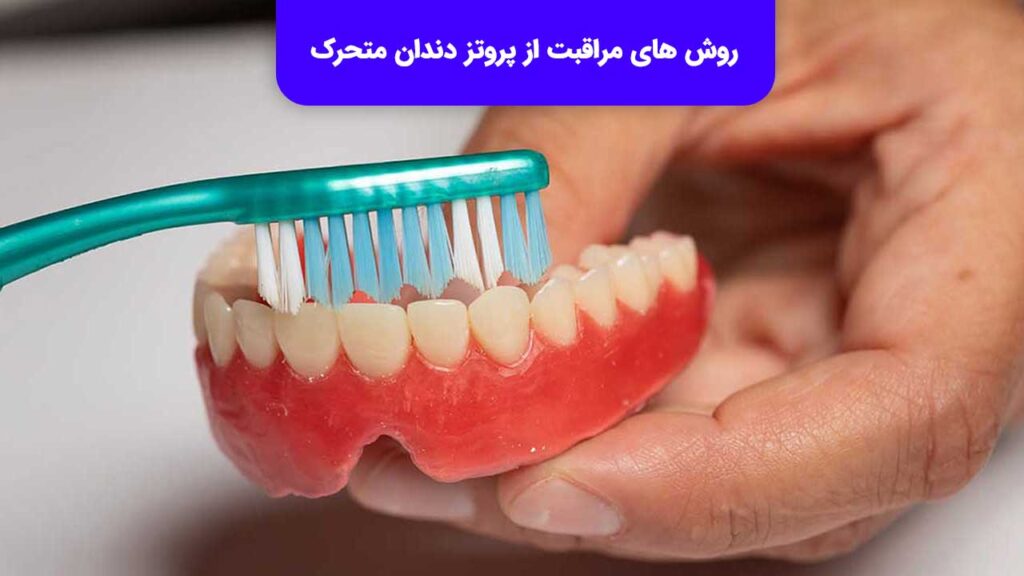 رعایت روش های مراقبت از پروتز دندان متحرک برای طول عمر بالا نیاز است.