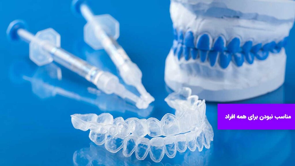بلیچینگ برای هر کسی مناسب نیست