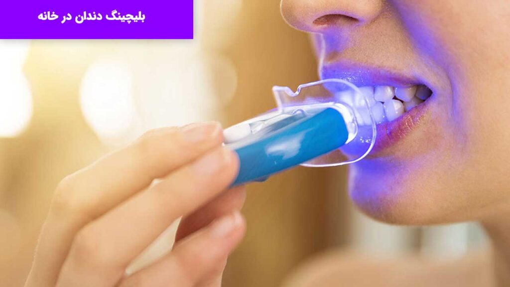 بلیچینگ در خانه امکان پذیر است