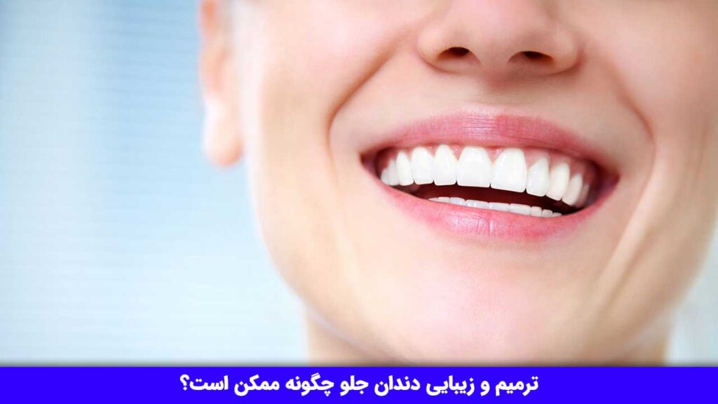 ترمیم و زیبایی دندان جلو