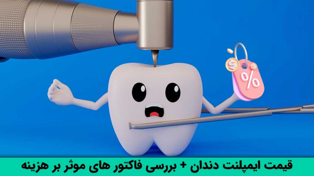 قیمت ایمپلنت دندان